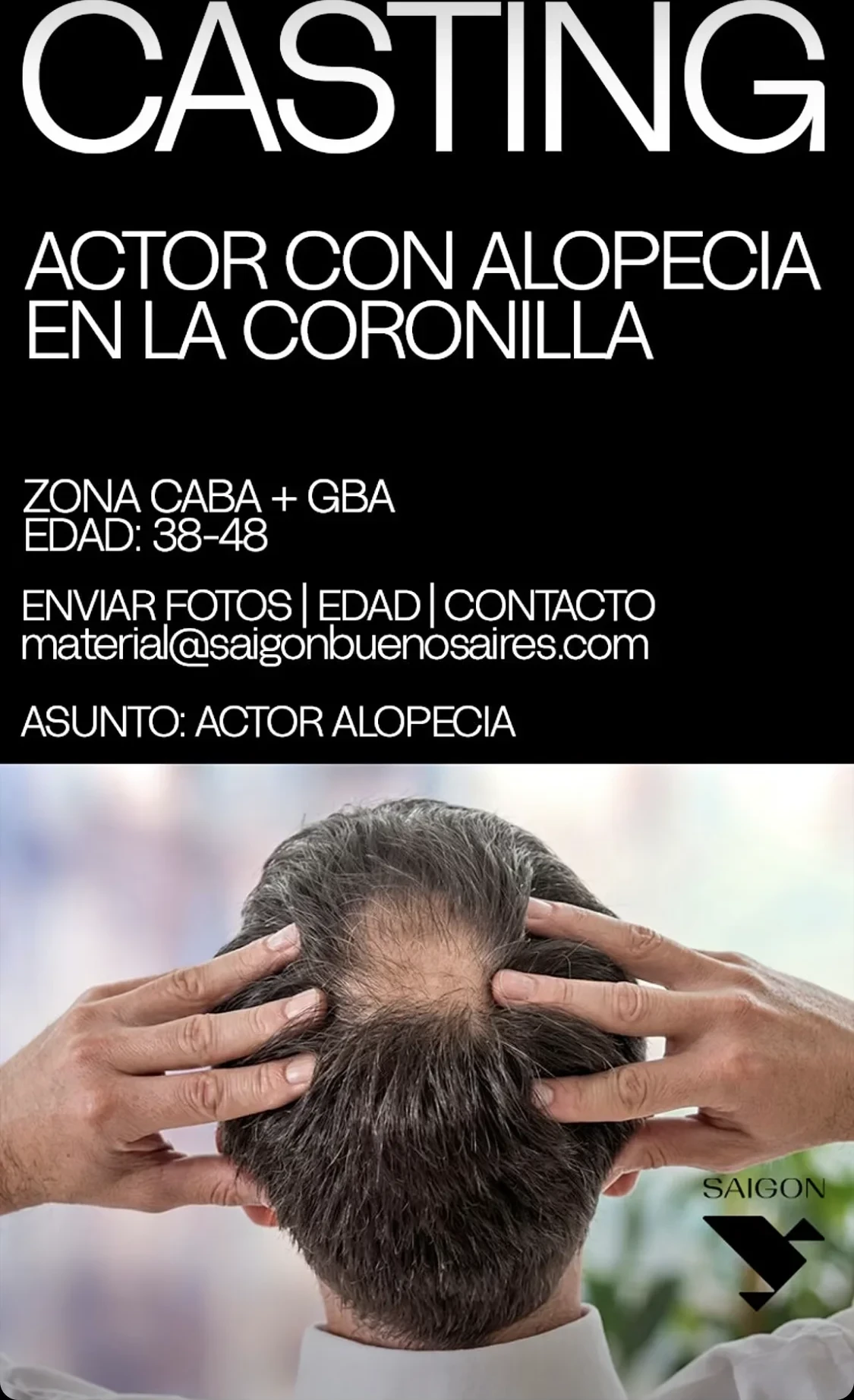 Actor con alopecia en la coronilla