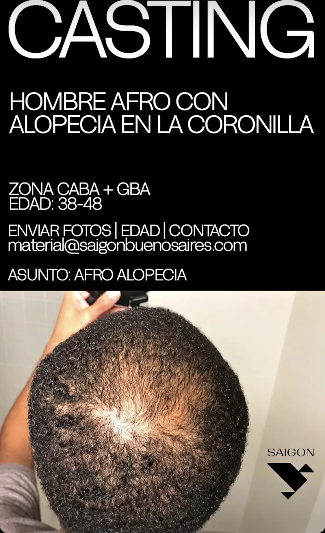 Hombre afro con alopecia en la coronilla