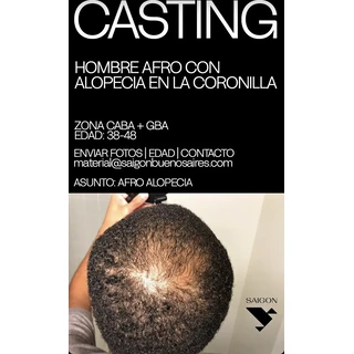 Hombre afro con alopecia en la coronilla